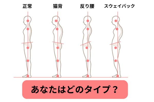 体の歪みチェック　脊柱のＳ字状カーブ