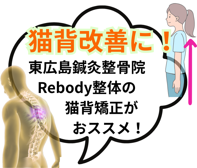 猫背矯正の改善なら東広島鍼灸整骨院Rebody整体にお任せください