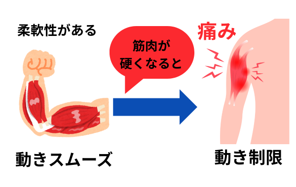 肩の筋肉の硬さは肩関節痛や動作制限の要因に