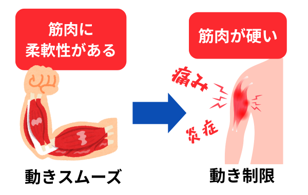 肩こりから肩関節の可動域制限に繋がる