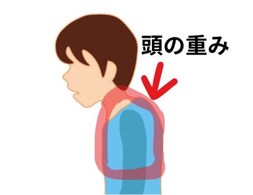 頭の重みが首や肩の筋肉に負担をかける