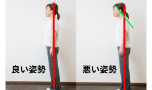 猫背チェック