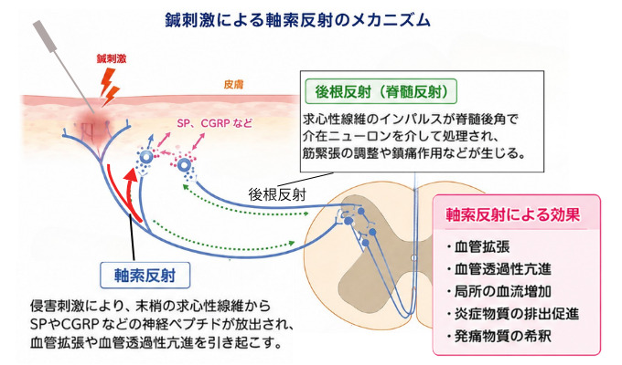 鍼刺激による軸索反射のメカニズム