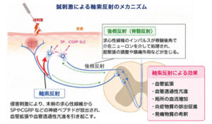鍼刺激による軸索反射のメカニズム