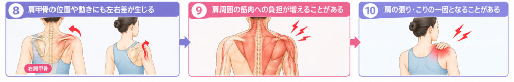 足元の歪みから肩こりに繋がる代償動作の一例　肩こりへの流れ