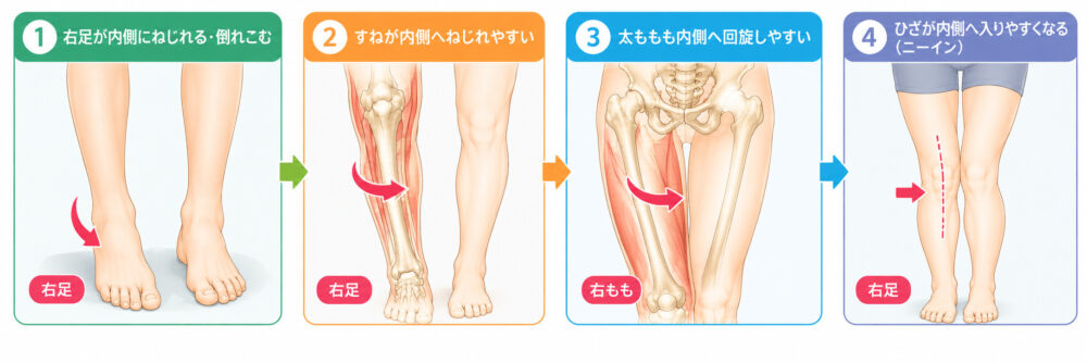 足元の歪みから肩こりに繋がる代償動作の一例　下肢の流れ
