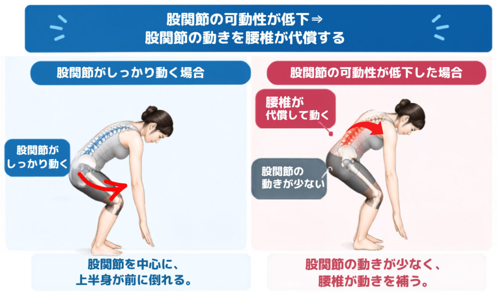 代償動作による腰痛事例